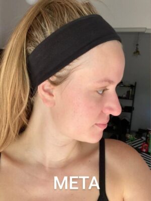 Мехлем при акне и пъпки с пчелен восък 30 мл 10 Мехлем при акне и пъпки с пчелен восък 30 мл - Image 10