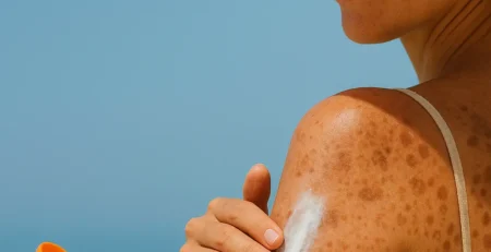 Стоп на пигментни петна с HappyMarket.bg – натурална грижа ☀️